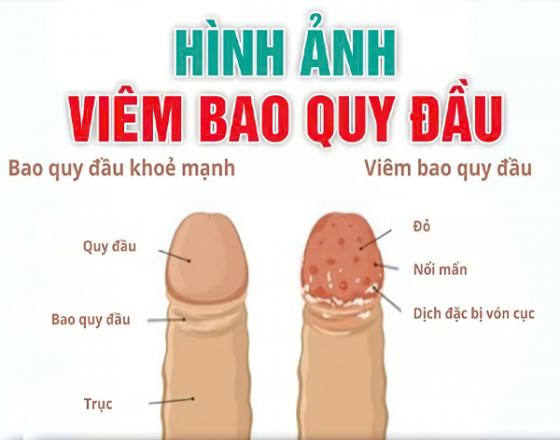 219.jpg